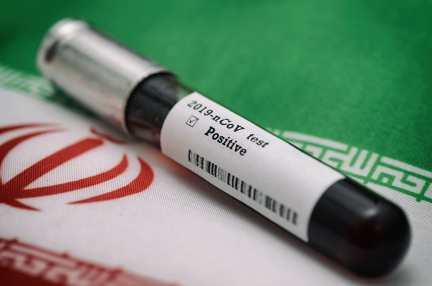 冠状病毒2019-nCoV血液样本。流行性病毒呼吸综合征库存照片。伊朗爆发冠状病毒疫情图片下载