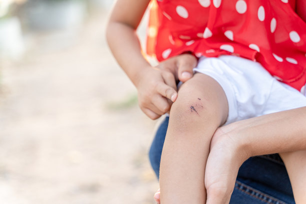 一个膝盖疼痛和擦伤的女孩。图片下载