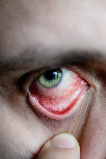 特写镜头红眼图片下载