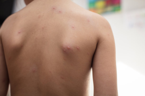 可能不太愉快。图片下载