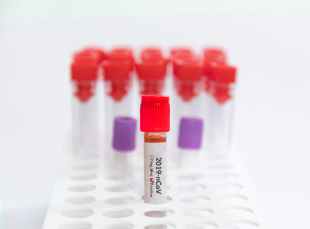 管内冠状病毒阳性血液样本图片下载