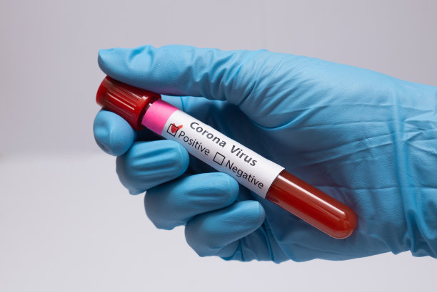 冠状病毒血液检测阳性。医学研究，带血的试管，手拿医用乳胶手套。冠状病毒爆发和流感。2019 - ncov covid-19,非典。高质量的照片。图片下载