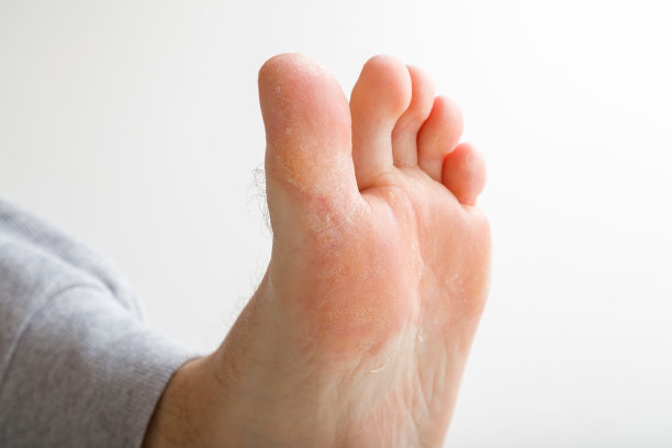 年轻人露出脚，皮肤干燥。特写镜头。图片下载