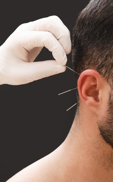 针灸治疗烟酒成瘾。传统中医有助于摆脱许多疾病和成瘾。图片下载