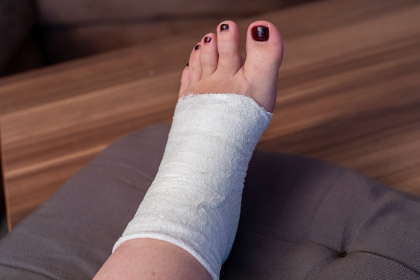 一位女士正在用绷带包扎他的脚伤图片下载