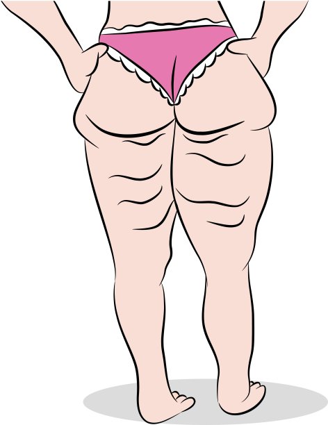 Celllulite大腿图片下载