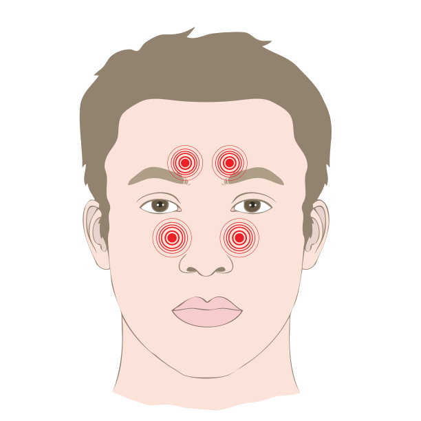 头痛，疾病鼻窦感染图片下载