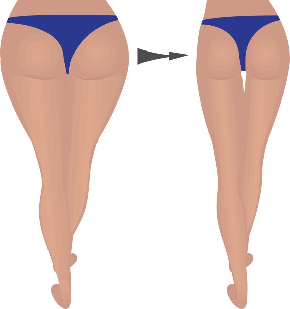 臀部减肥。脂肪和苗条。之前和之后图片下载