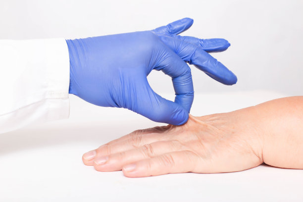 一位美容师正在检查一位老年妇女手上干燥而起皱的皮肤。手部嫩肤的概念，弹性和补水的程序图片下载