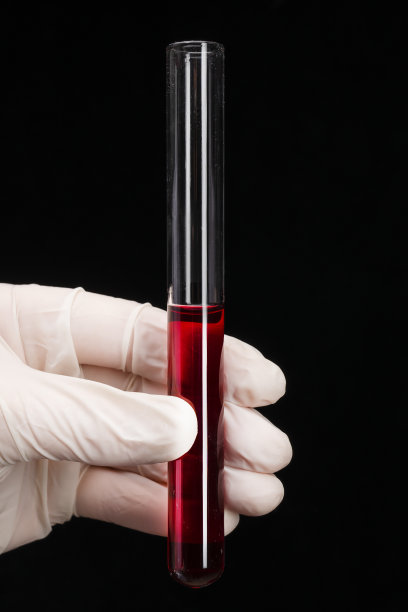 手上拿着红色液体的试管，验血。垂直特写照片上的黑色背景图片下载