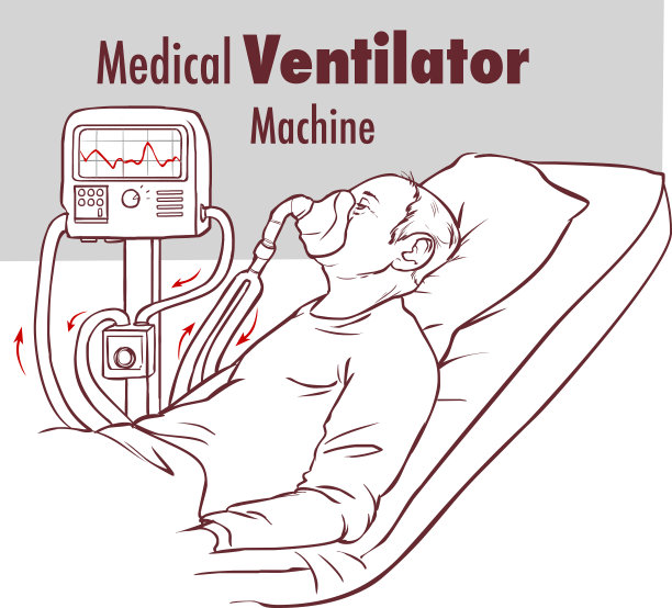 呼吸机气管切开术患者手术室呼吸医疗机械设备外科医院临床重症监护病房图片下载