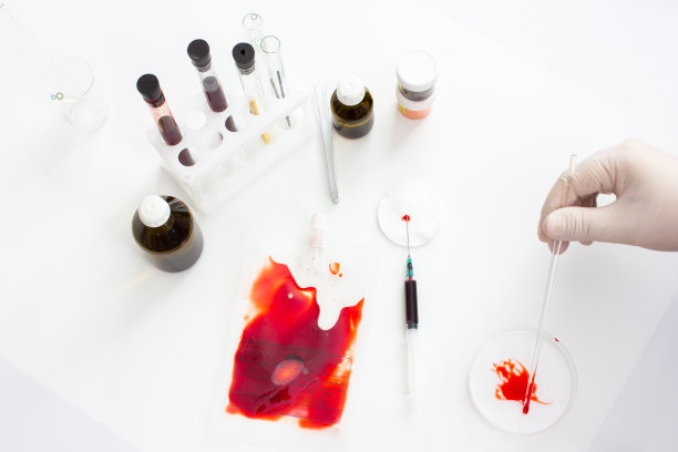 冠状病毒疫苗的开发。该实验室用于研究携带该病毒的患者的血液图片下载