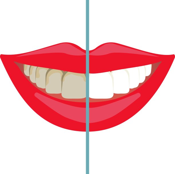 前后牙齿美白图片下载