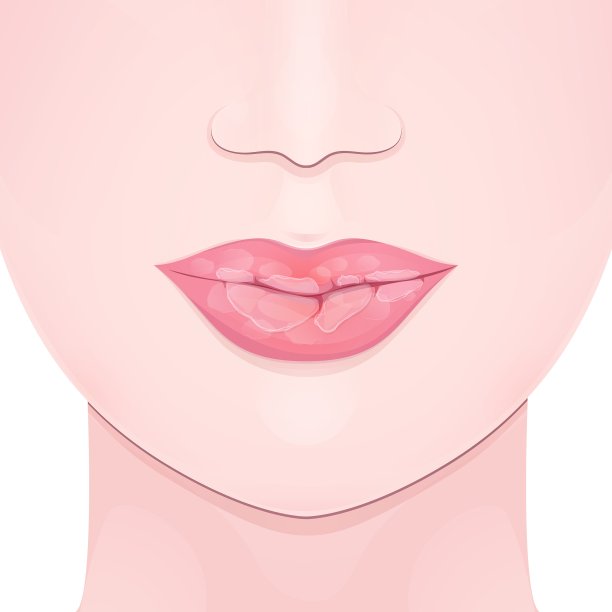 干燥开裂的嘴唇图片下载