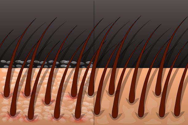 头发和皮屑图片下载