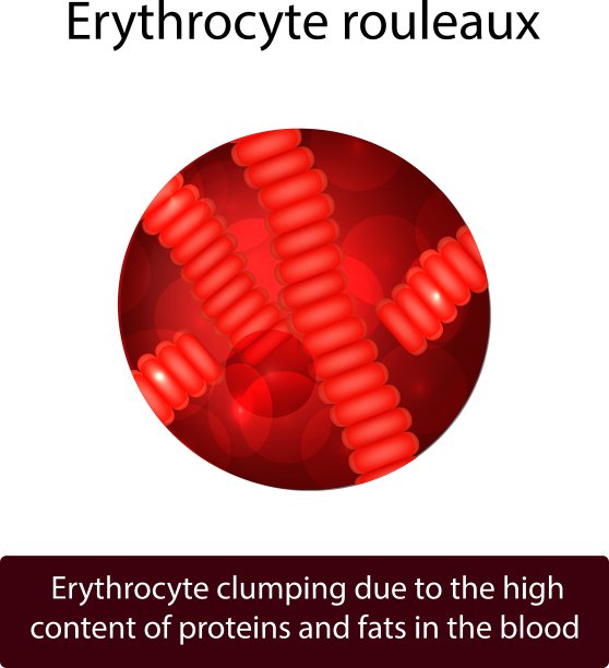红细胞凝结图片下载