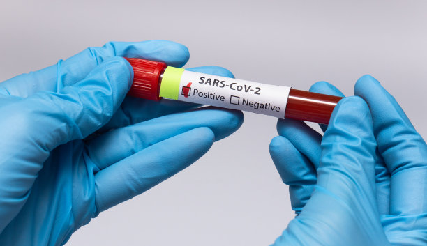 冠状病毒血液检测阳性。医学研究，带血的试管，手拿医用乳胶手套。冠状病毒爆发和流感。2019 - ncov covid-19,非典。高质量的照片。图片下载