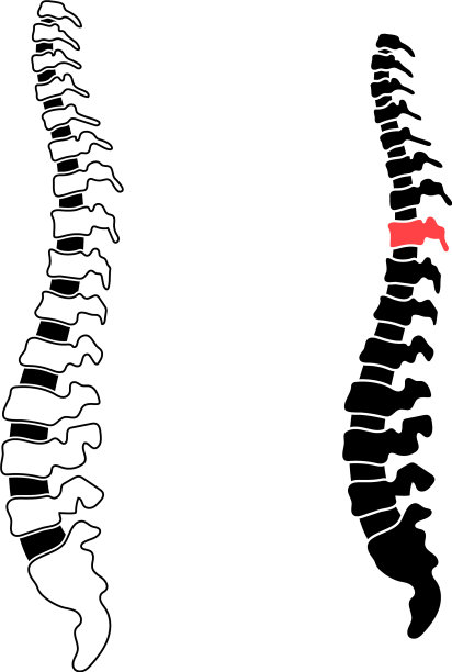 人类的脊椎图片下载