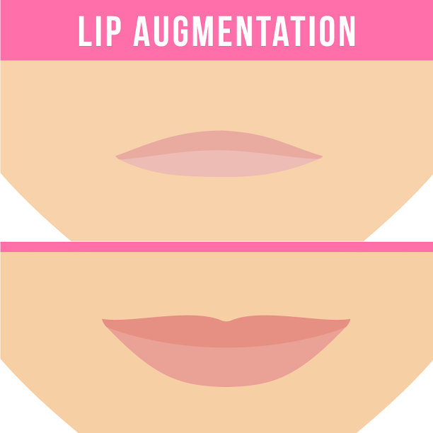 唇术效果图片下载