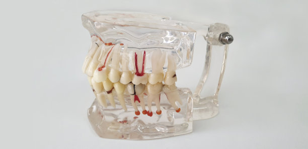 牙科模型，带修复桥，牙科牙，用于医学研究和培训(植牙)图片下载