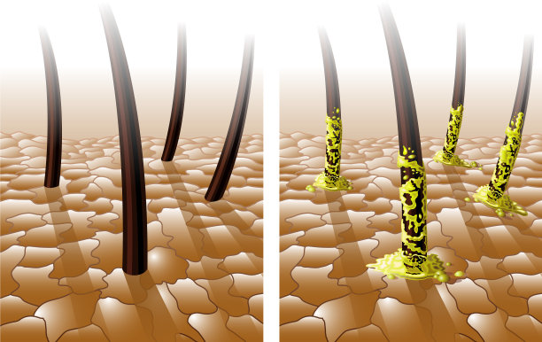 正常油性发质图片下载