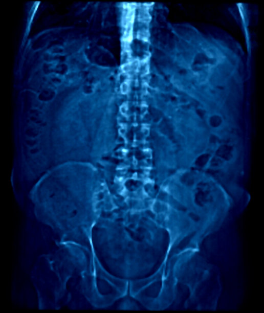 用于医生检查的冠状x线图像图片下载