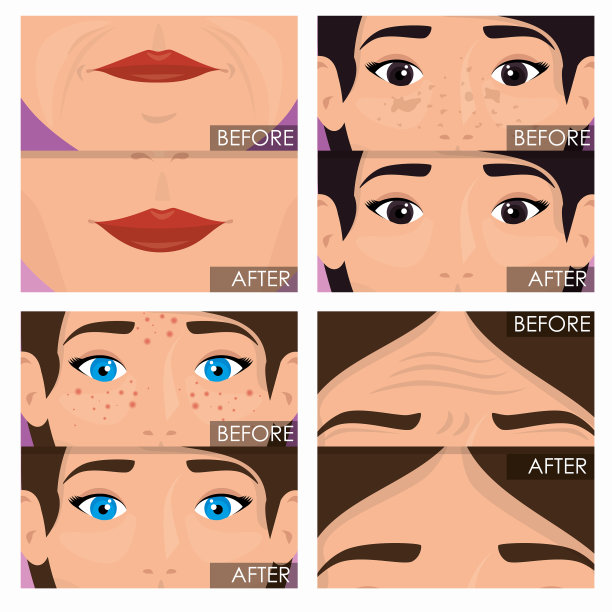 女性皮肤治疗前后图片下载