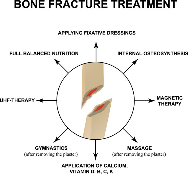 用骨骨折治疗骨折图片下载