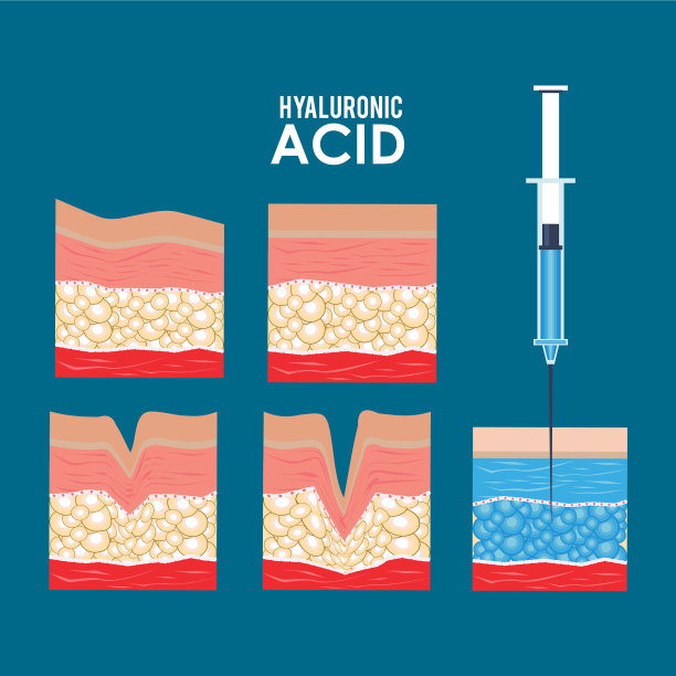 透明质酸注射液填充物信息图图片下载