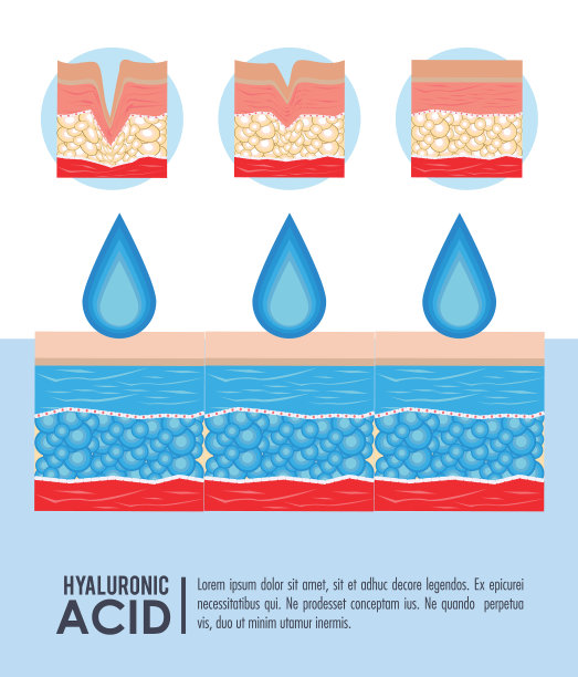透明质酸注射液填充物信息图图片下载