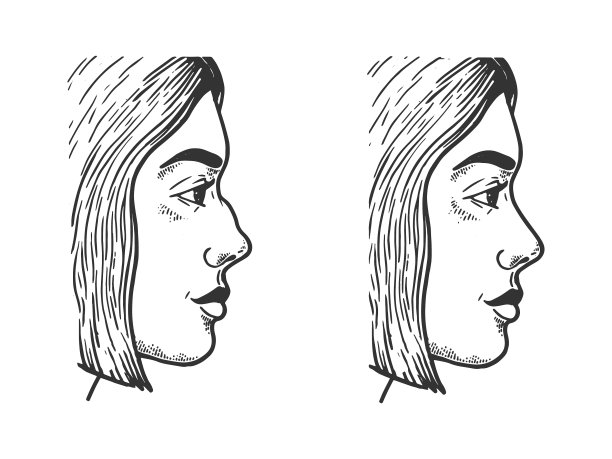 女人脸鼻整形裙素描图片下载