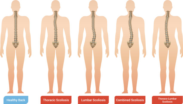 脊柱曲度信息图表集图片下载