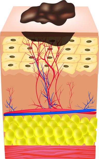 痣的结构痣的结构图片下载