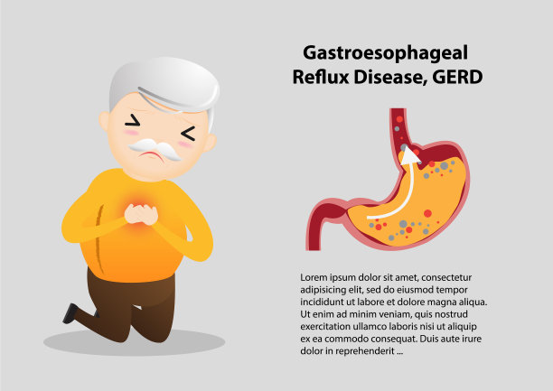 胃食管反流病gerd图片下载