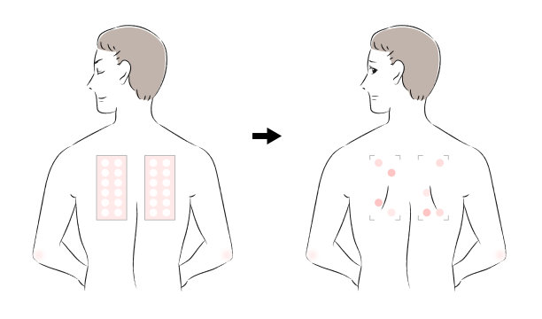 前后对男性进行贴片测试图片下载