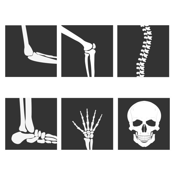 人工关节膝盖图片下载