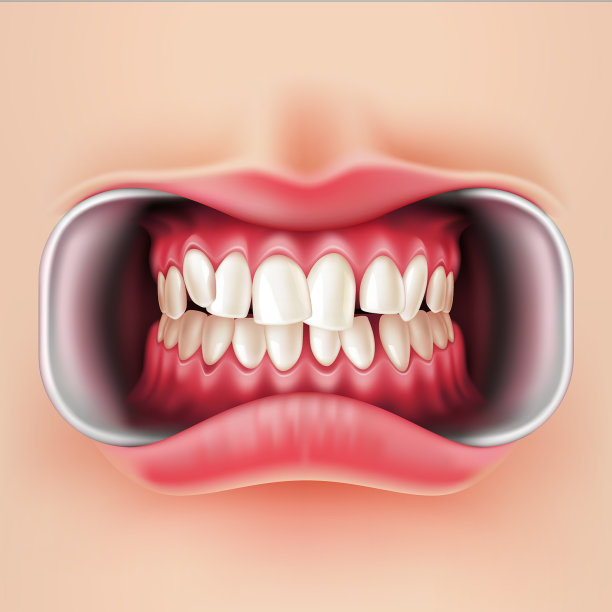口腔支架系统3d图片下载