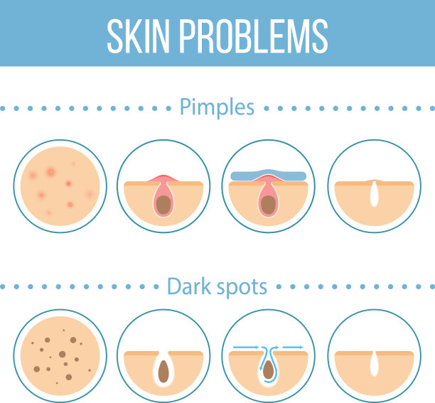 皮肤问题的图标图片下载