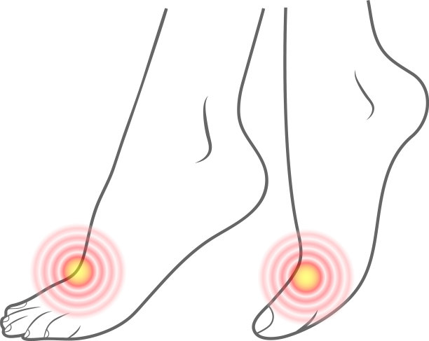 人体足部轮廓和红点的疼痛做好准备图片下载