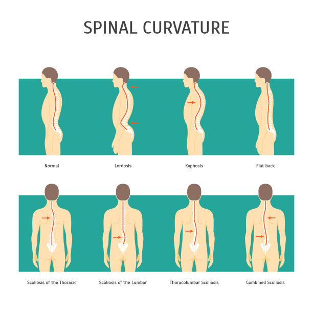 卡通背部与脊柱侧弯卡片海报图片下载