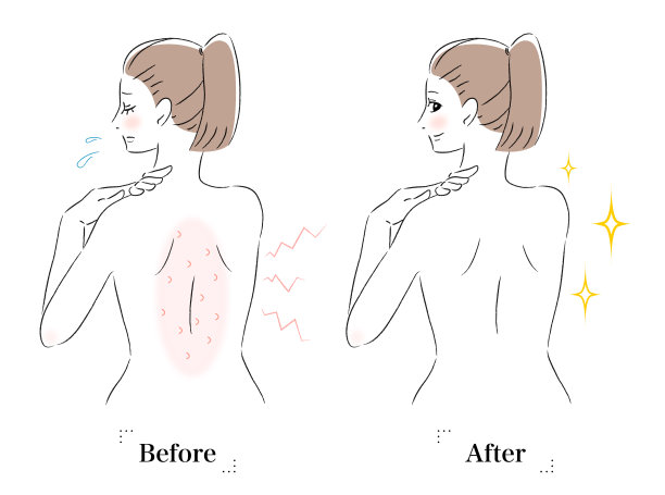 妇女瘙痒前后的插图图片下载