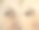 女性眼部皱纹治疗前后，眼睑成形术图片下载