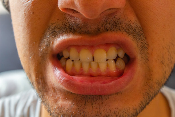 愤怒的嘴图片下载