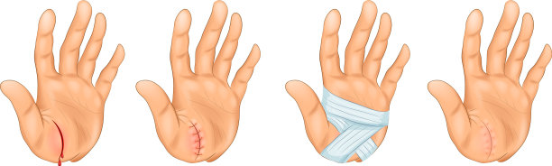 减少手头图片下载