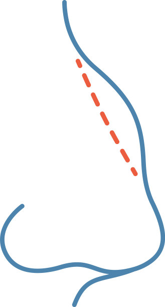 鼻整形术彩色图标图片下载