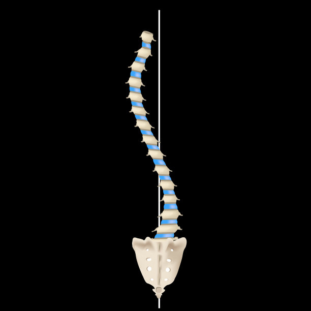 s型脊柱侧弯，右旋脊柱侧弯，左旋脊柱侧弯图片下载