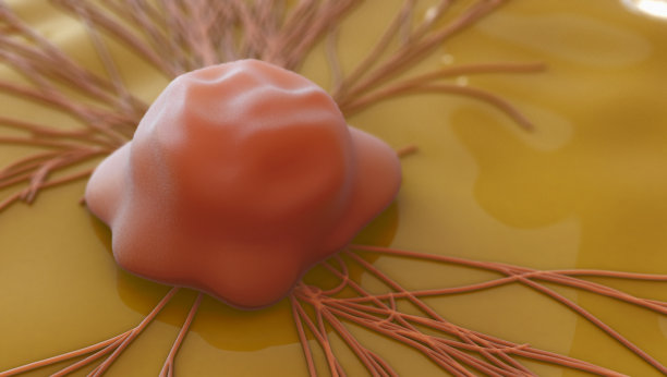 宫颈癌细胞图片下载