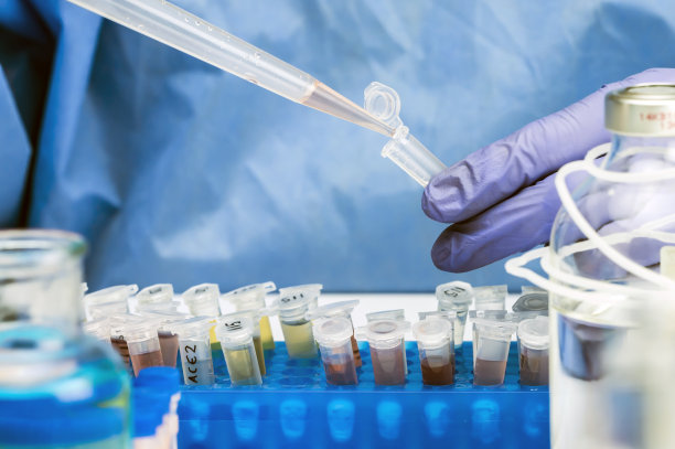 在实验室对废水样本进行科学分析，对人类可能受到Sars-Cov-2污染的调查，概念图像图片下载