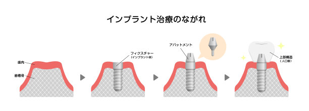 种植过程平面矢量图(日文)图片下载