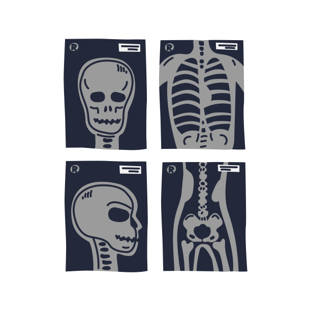x光照片。人体胸部、头部正面、侧面及臀部x线照片。医疗保健和健康。平面风格矢量插图上的白色背景图片下载